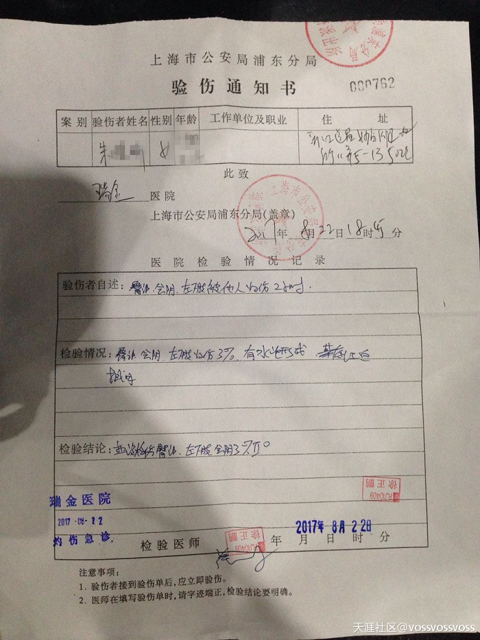 中金网协商无果竟升级施暴<strong></p>
<p>中金黄金网</strong>！年轻女员工惨遭其侮辱！